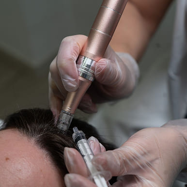 PRP therapy for hair growth procedure to reduce hair fall and improve hair density