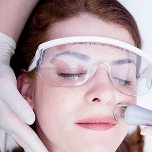 Laser Skin Resurfacing Treatment