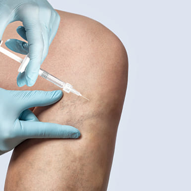 Areas Treated with Botox