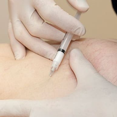 botox for facial contouring