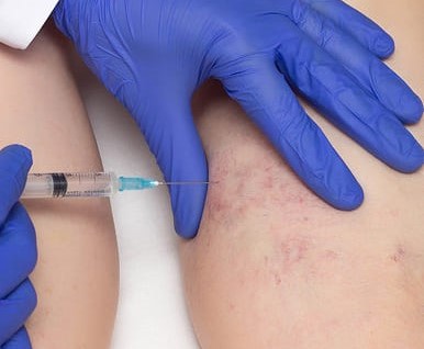Botox Treatment Cost in Pune
