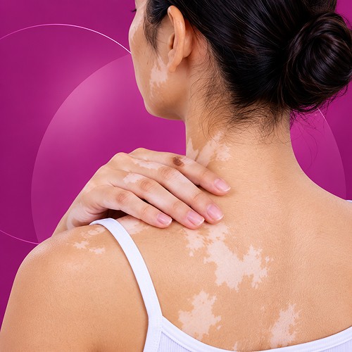 hair and skin specialist clinic in Pune